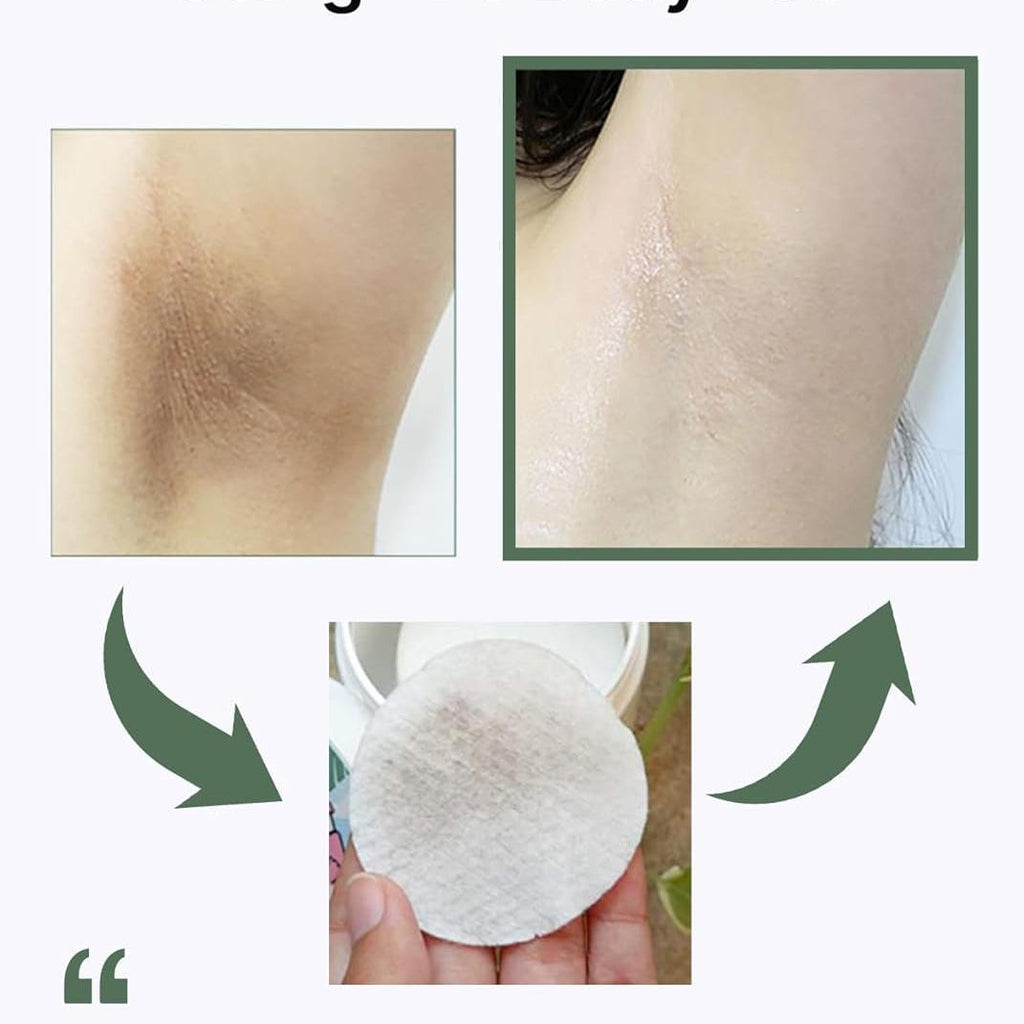 celimax ONE STEP Body Brightening Pad | with Green Tea & White Truffle, for Underarm, Knee & Elbow, Gentle Exfoliating & Hydrating Body Scrub, 110ml (60 pads)