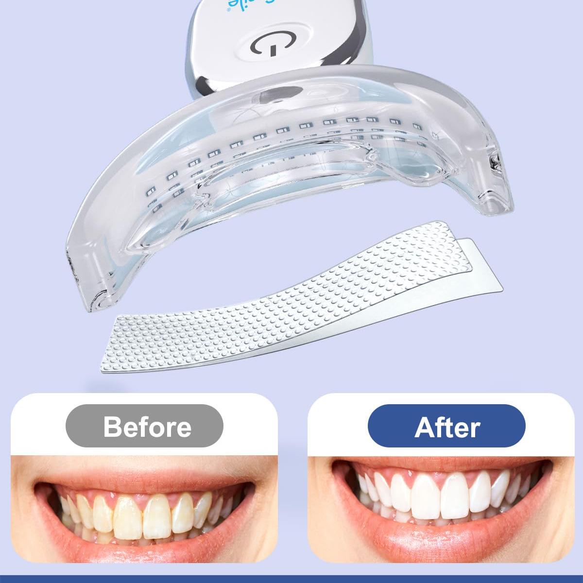 MySmile Teeth Whitening Pen 30+ Treatment Enamel Safe Tooth Whitening Gel for Teeth Sensitive-10 Min Fast Whitening Teeth-Helps to Remove Stains from Coffee, Smoking, Wines-Mint Flavor