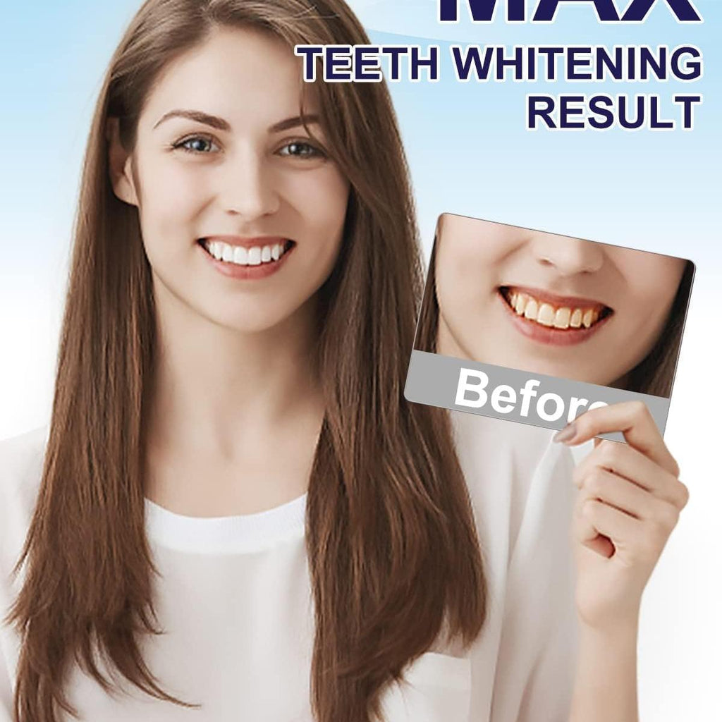 MySmile Teeth Whitening Pen 30+ Treatment Enamel Safe Tooth Whitening Gel for Teeth Sensitive-10 Min Fast Whitening Teeth-Helps to Remove Stains from Coffee, Smoking, Wines-Mint Flavor