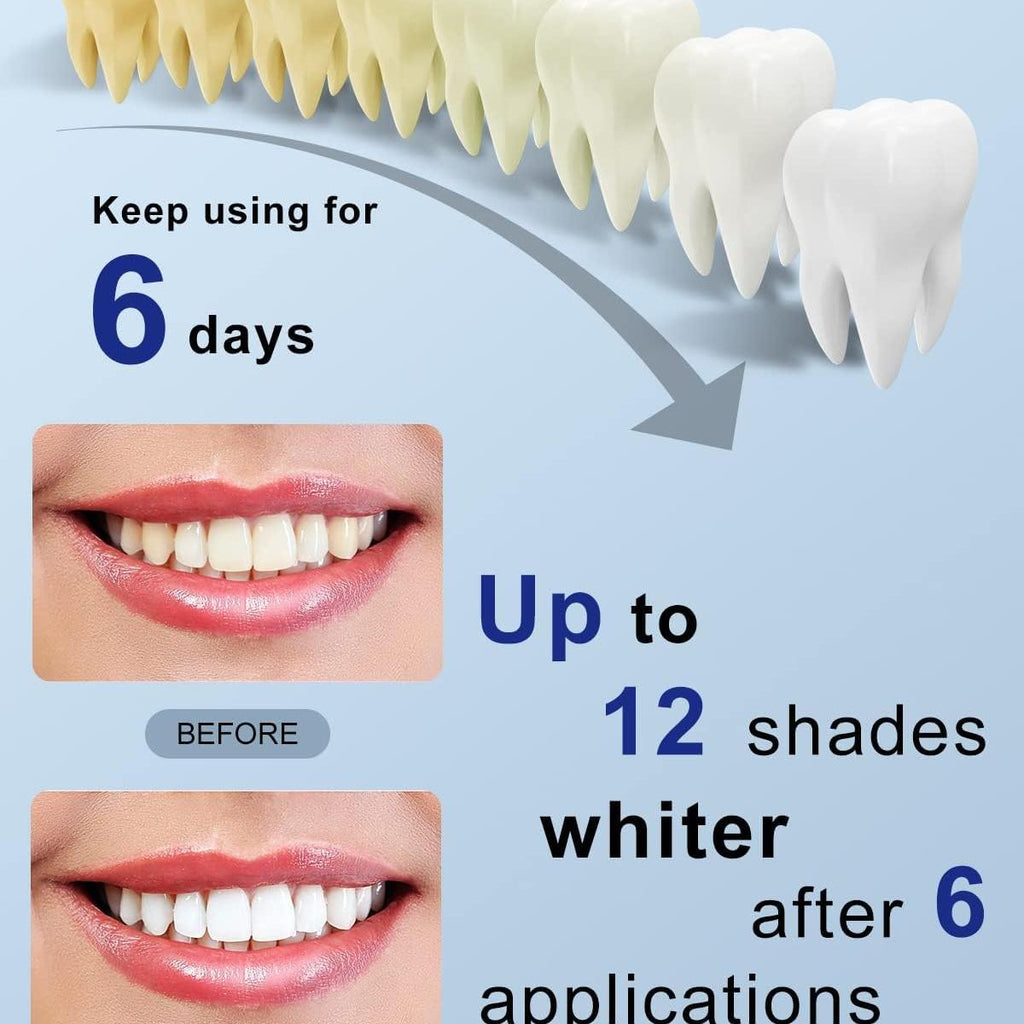 MySmile Teeth Whitening Pen 30+ Treatment Enamel Safe Tooth Whitening Gel for Teeth Sensitive-10 Min Fast Whitening Teeth-Helps to Remove Stains from Coffee, Smoking, Wines-Mint Flavor