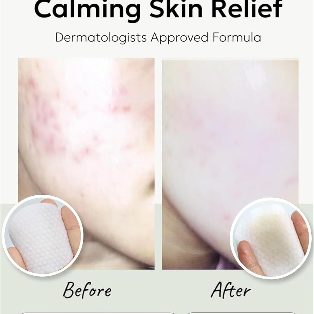 celimax Ji.Woo.Gae Pore+Dark Spot Brightening Pad (40 Pads) + Ji.Woo.Gae Heartleaf BHA Peeling Pad (60 pads) Bundle