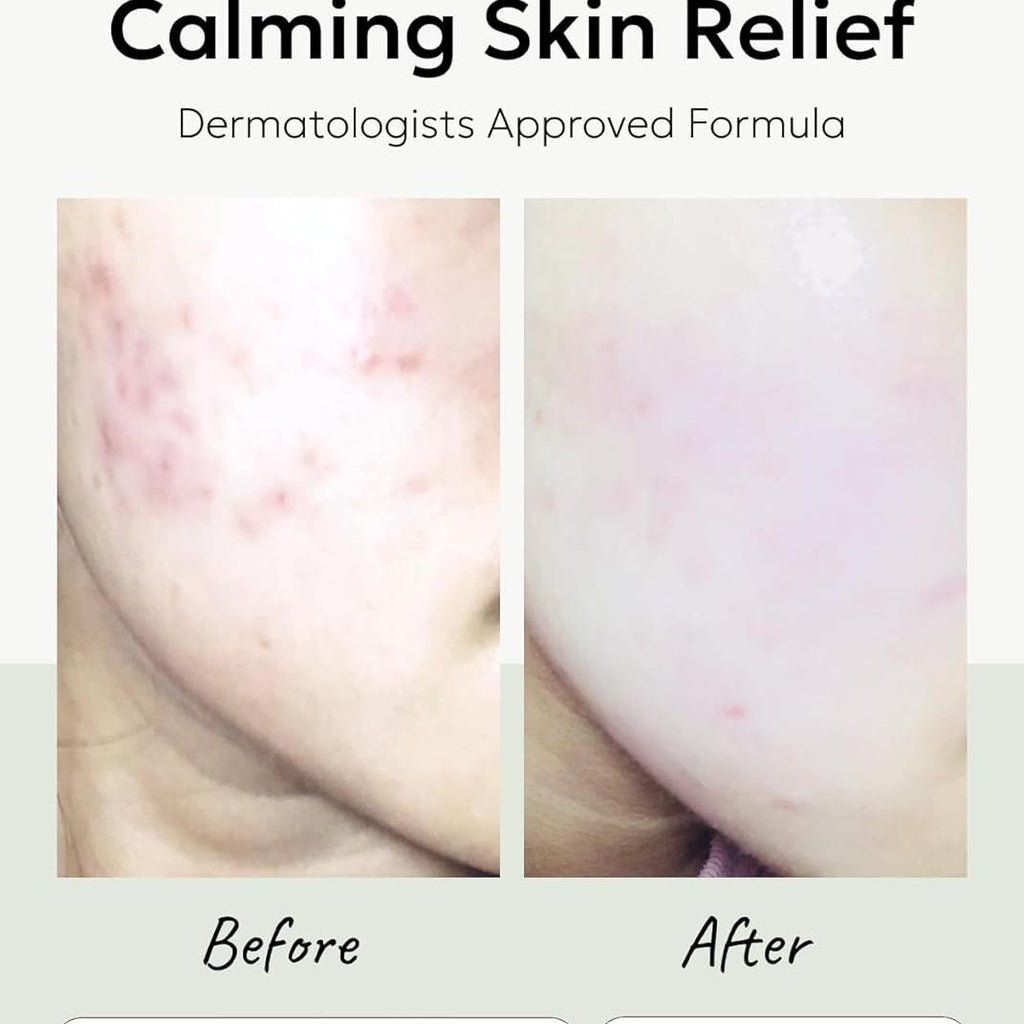 celimax The Real Cica Niacinamide AC Calming Serum 40ml + Ji.Woo.Gae Heartleaf BHA Peeling Pad(60 pads) Bundle