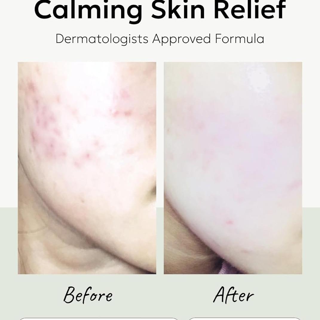 celimax The Real Cica Niacinamide AC Calming Serum 40ml + Ji.Woo.Gae Heartleaf BHA Peeling Pad(60 pads) Bundle