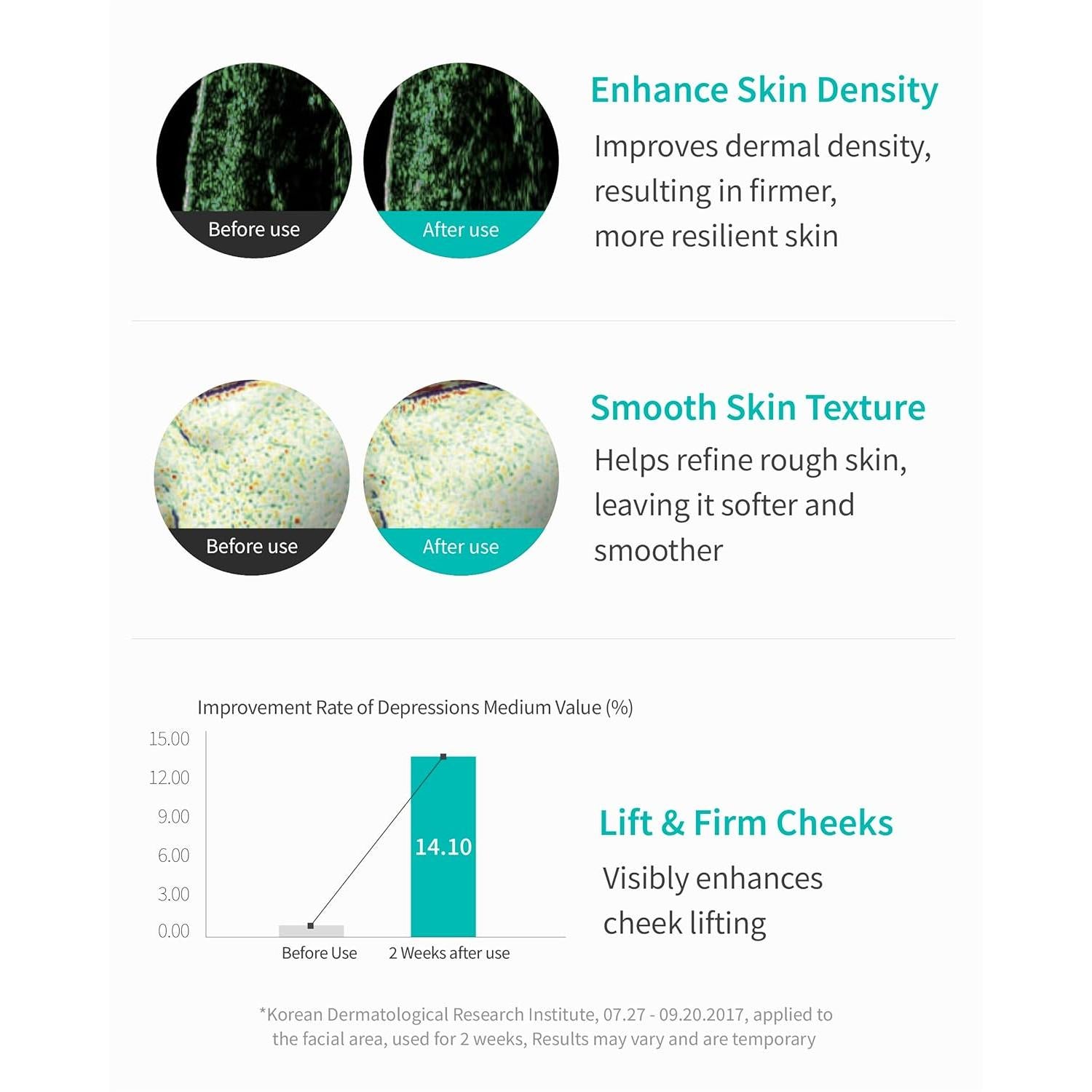 REJURAN® Skincare Repair Set with c-PDRN® – Turnover Ampoule & Skin Protection Sheet Mask for Firming, Hydration, and Barrier Repair – Korean Salmon DNA Serum & Mask Duo (1.69 fl oz + 5 Masks)