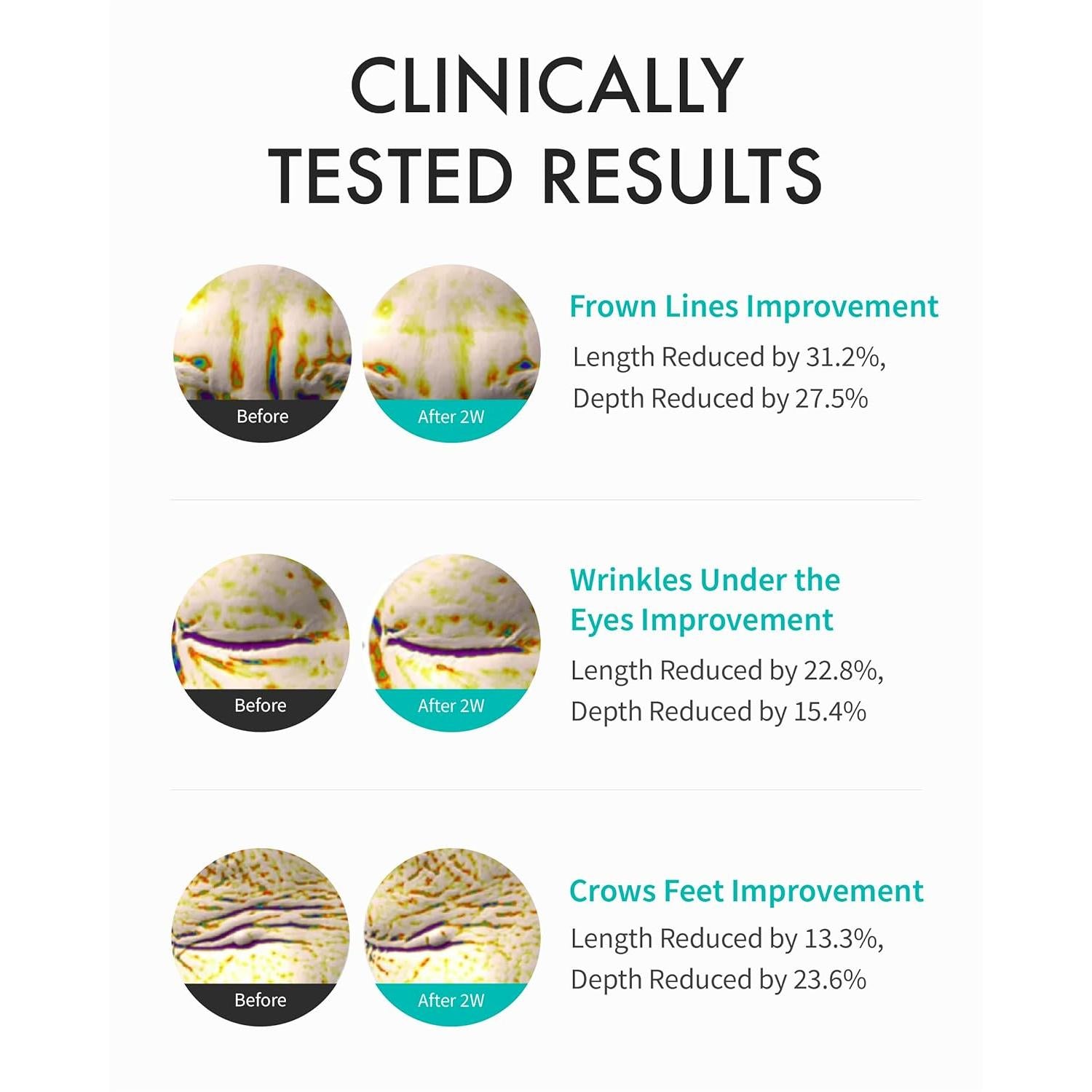 REJURAN® Intensive Eye Cream, c-PDRN® - Fast-Acting Eye Treatment for Wrinkles, Lifting, and Dark Circles. Instant Hydration and Visible Revitalization. Korean Skin Care (0.67 fl oz)