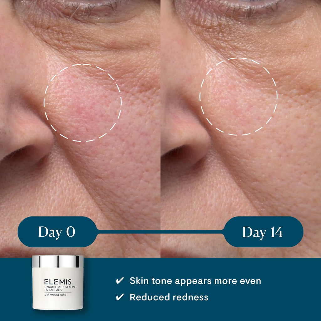 ELEMIS Dynamic Resurfacing Facial Pads, Gentle Textured Treatment Facial Exfoliating Pads
