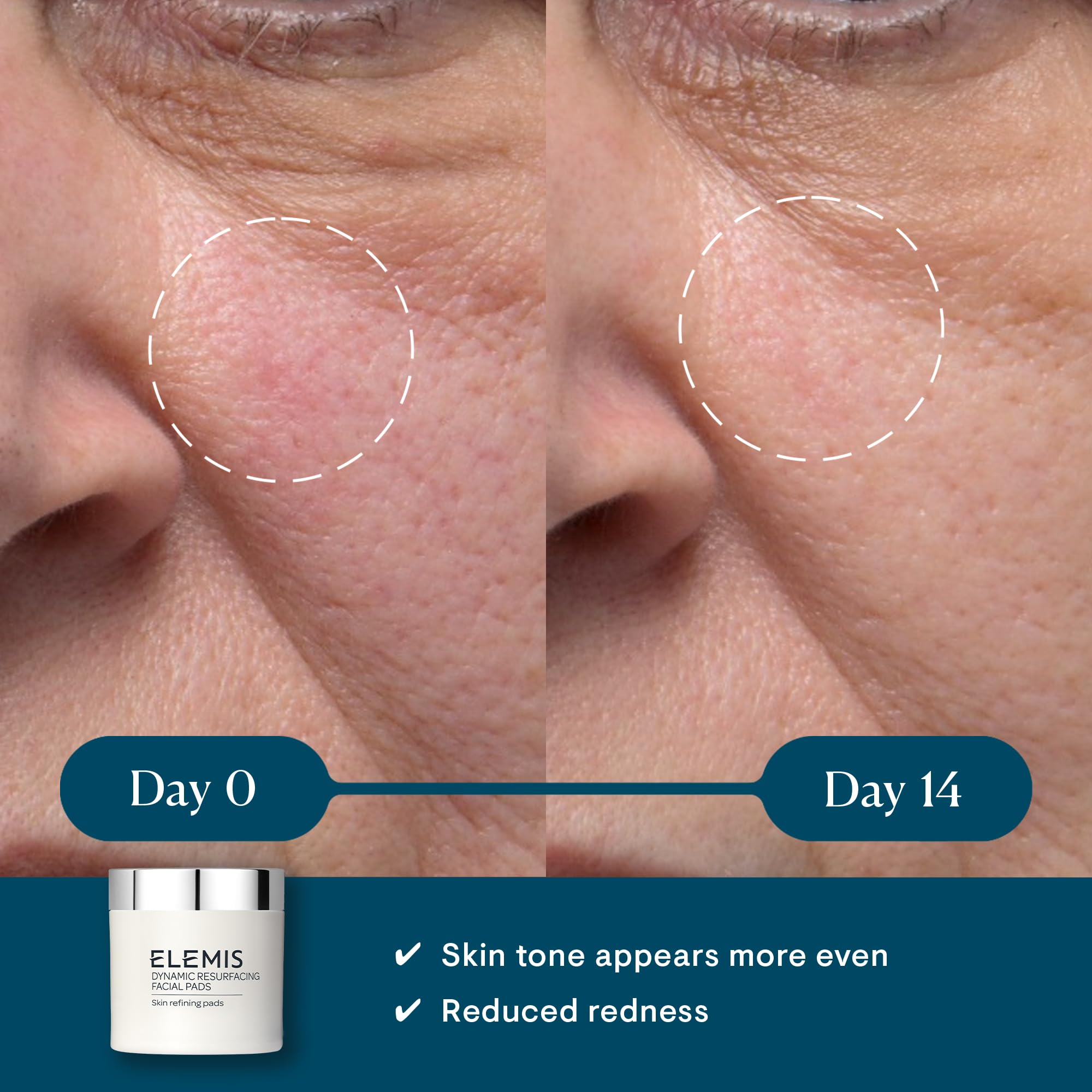 ELEMIS Dynamic Resurfacing Facial Pads, Gentle Textured Treatment Facial Exfoliating Pads