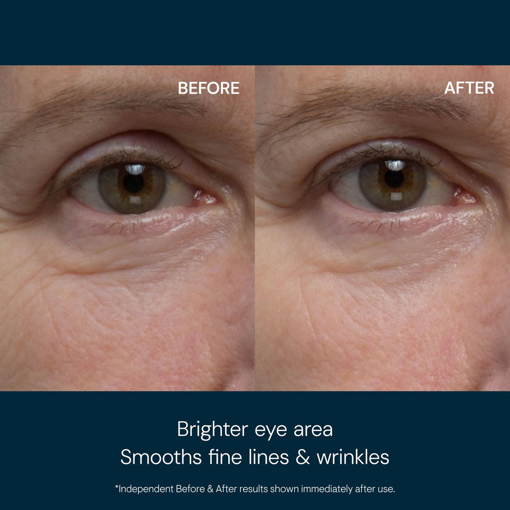 ELEMIS Pro-Collagen Eye Revive Mask | Anti-Wrinkle Multi-Use Treatment Brightens, Rejuvenates, Plumps and Hydrates for a More Youthful Look