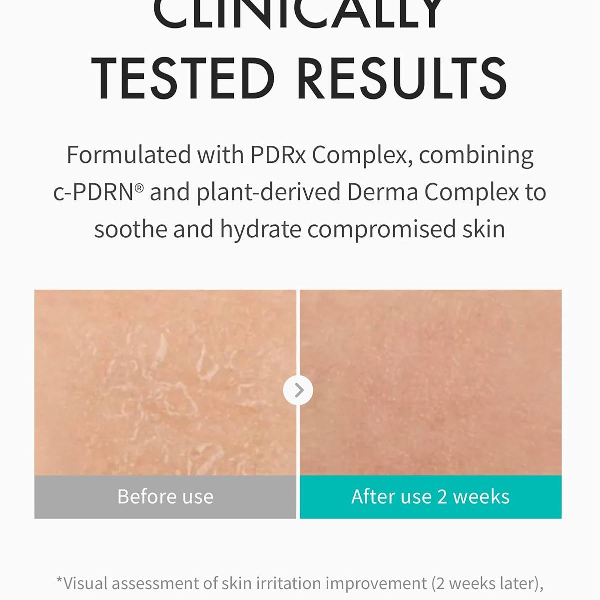 REJURAN® Moisture Cream, c-PDRN® - Daily Moisturizer for Long-Lasting Hydration and Skin Barrier Support with PDRx. (2.11 oz)