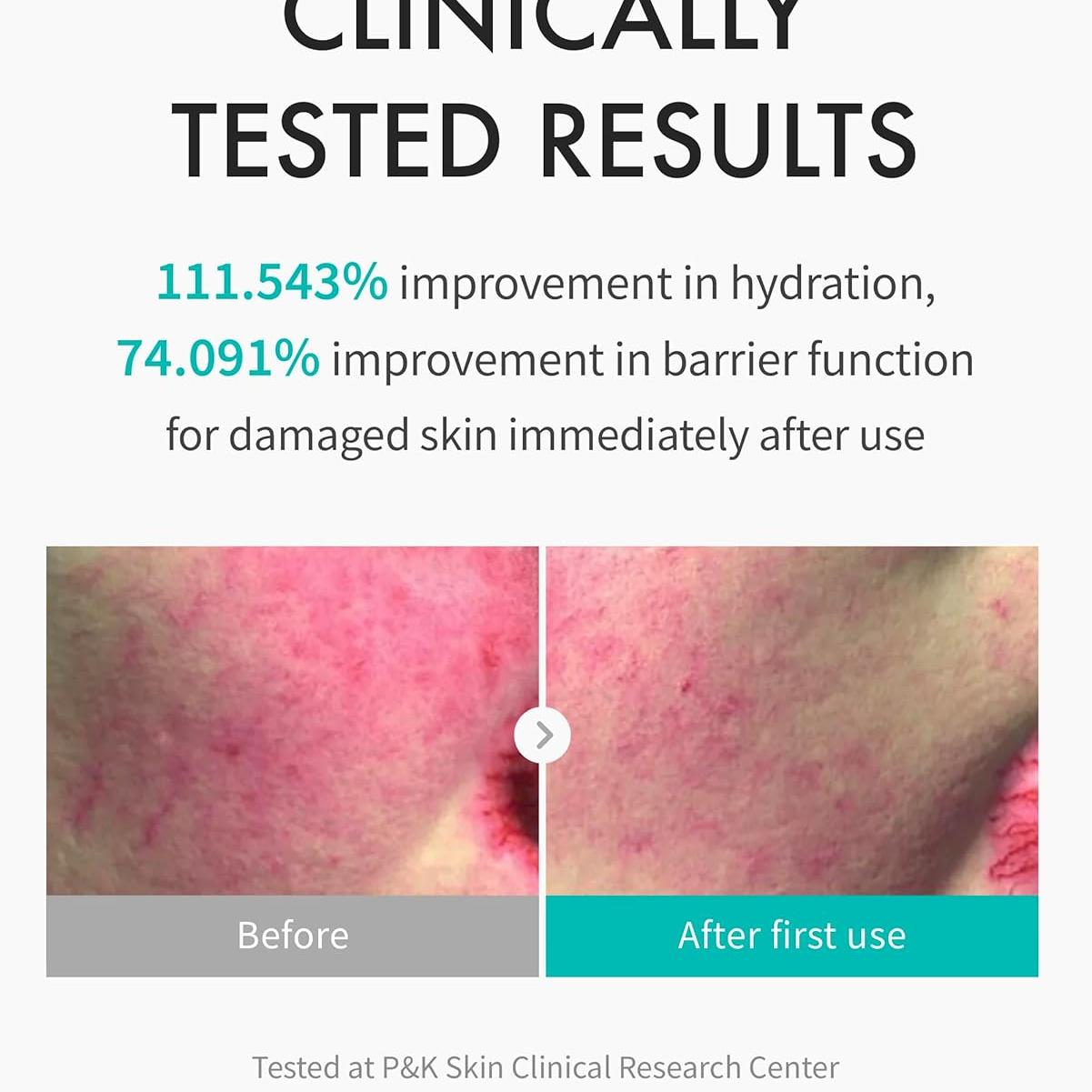 REJURAN® Moisture Treatment Ampoule, c-PDRN® - Deep Hydrating Face Serum for Instant & Long-Lasting Moisture, Soothing, Skin Barrier Boost, Moisture Lock with PDRx. Korean Skin Care (1.01 fl oz)