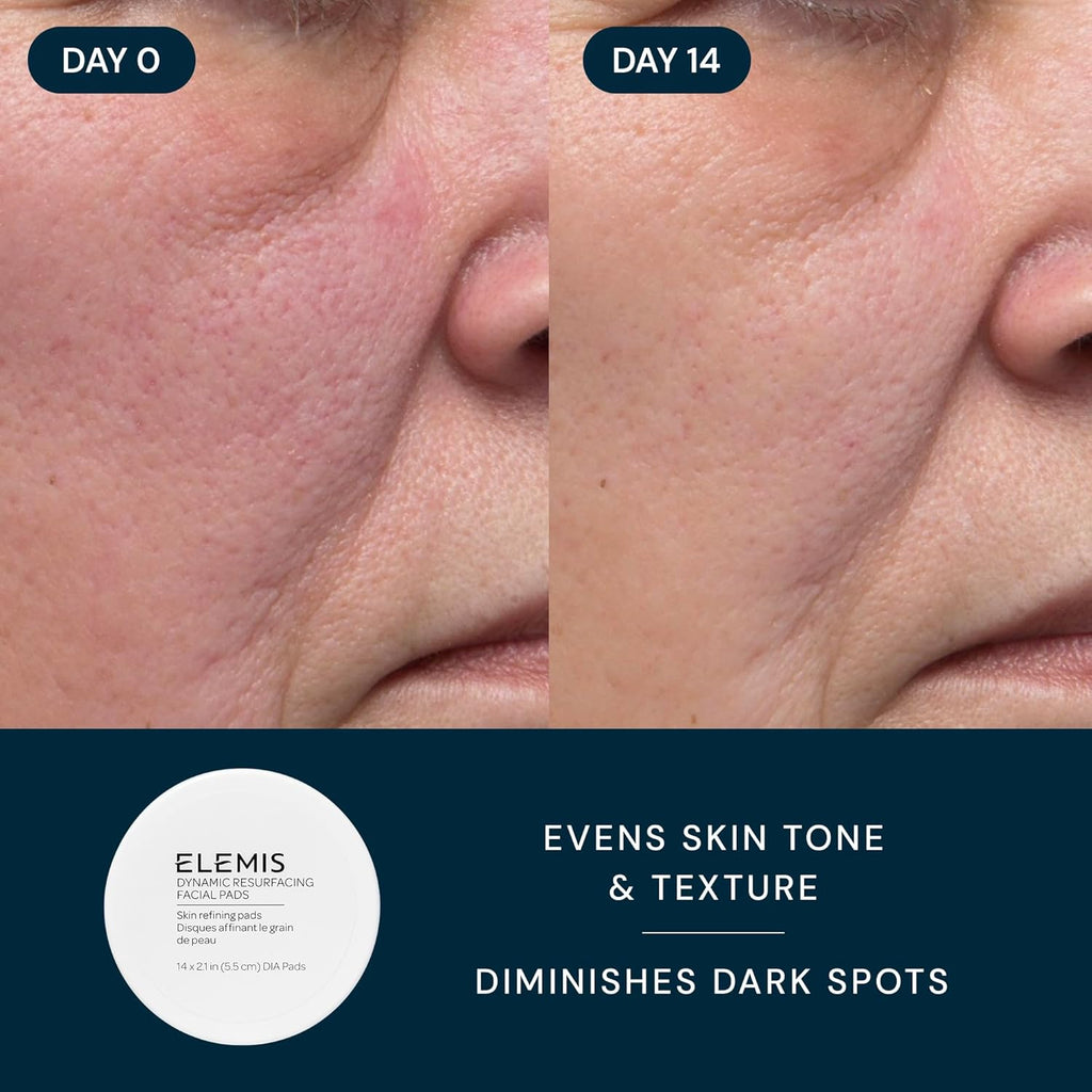 ELEMIS Healthy Skin Exclusive Travel Set | Pro-Collagen Cleansing Balm Mini, Marine Cream SPF 30 Mini & Dynamic Resurfacing Pads | Anti-Aging Hydrating Skincare Travel Kit