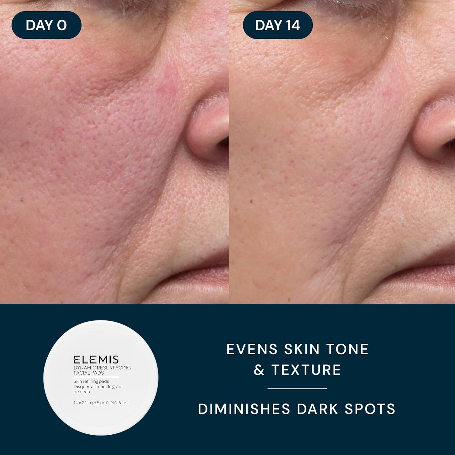 ELEMIS Healthy Skin Exclusive Travel Set | Pro-Collagen Cleansing Balm Mini, Marine Cream SPF 30 Mini & Dynamic Resurfacing Pads | Anti-Aging Hydrating Skincare Travel Kit