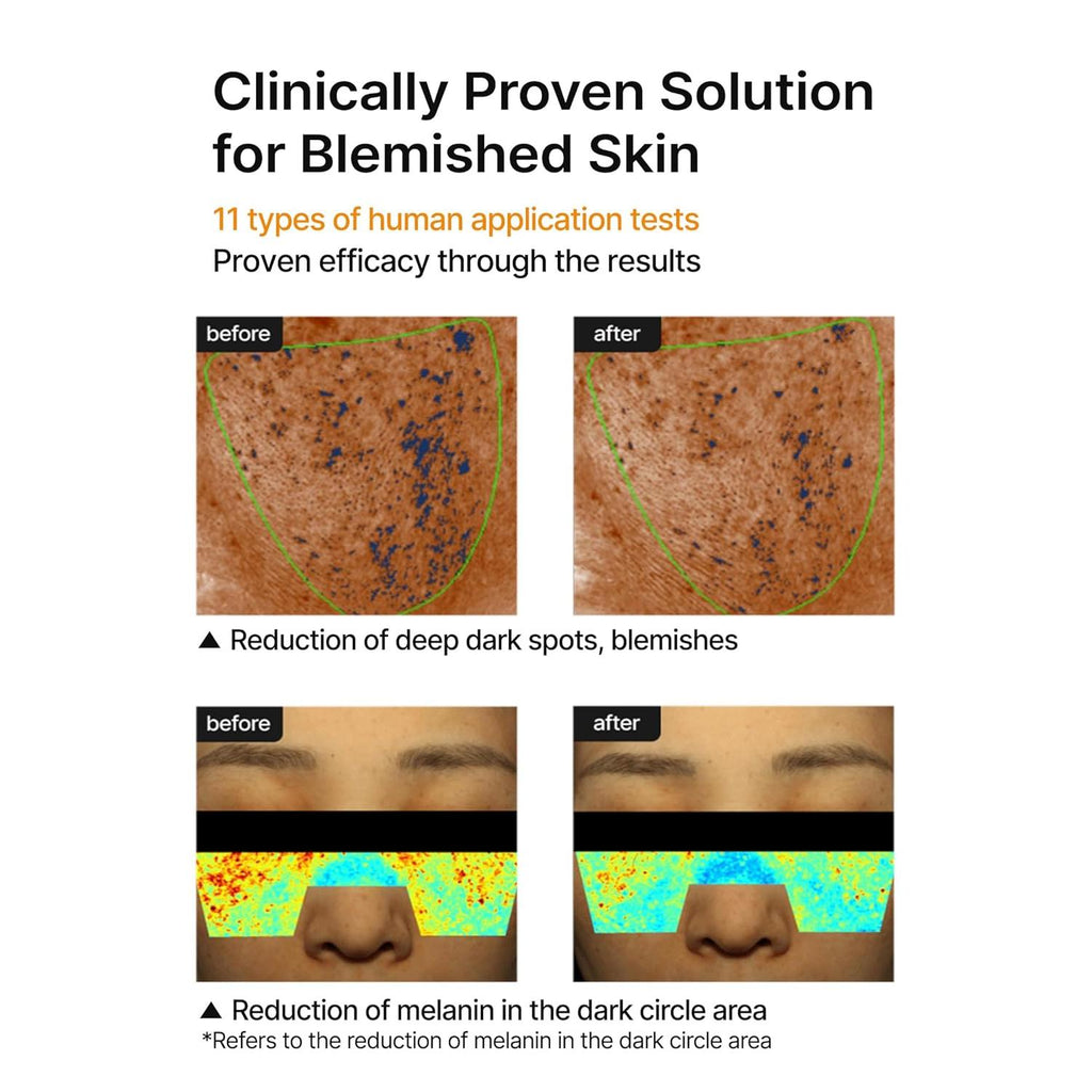 celimax Pore+Dark Spot Brightening Cream | with Niacinamide, Tranexamic Acid, TXA Cream, Pore Minimizer, Non-Irritating, Hydrating, For Sensitive Skin, Holiday Gift, 35ml