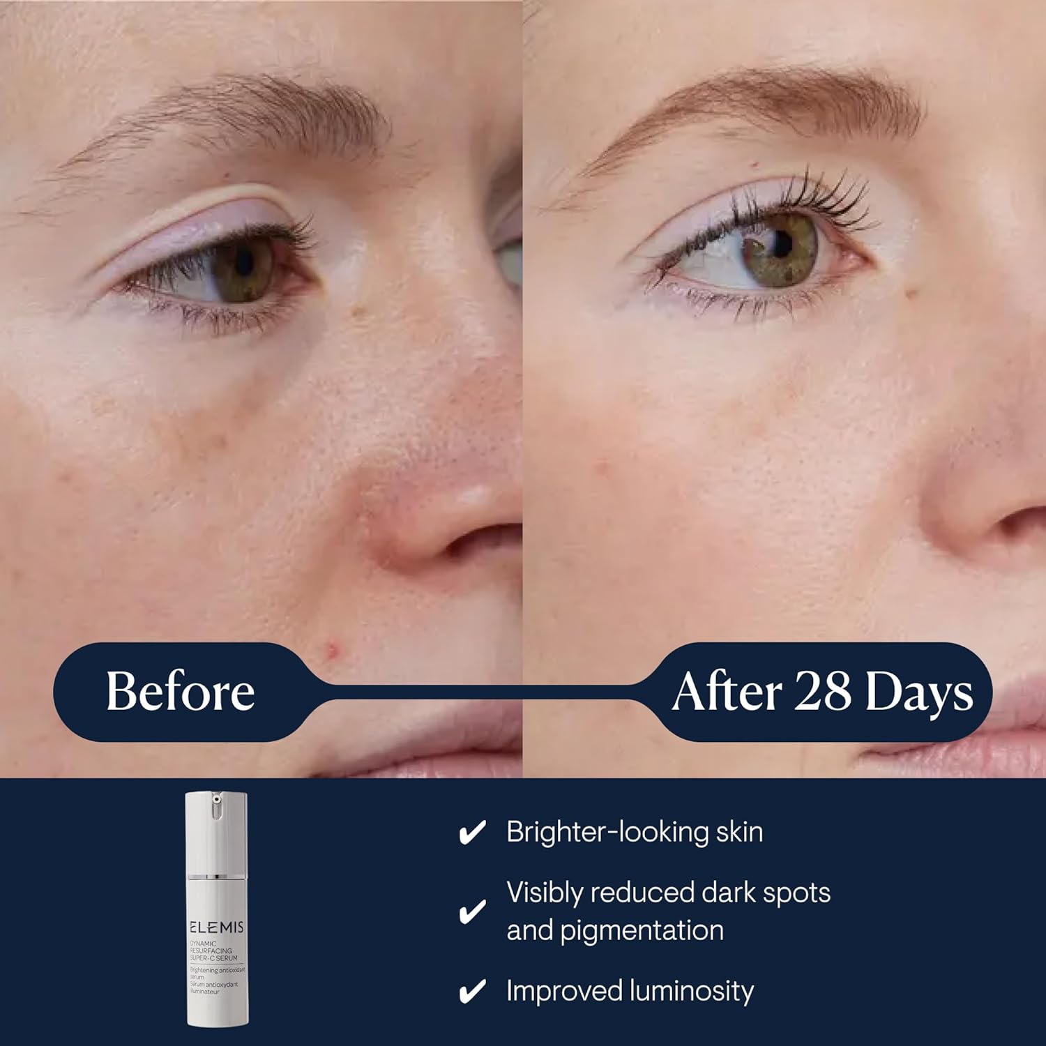 ELEMIS Dynamic Resurfacing Super-C Serum, Daily Anti-Aging Antioxidant Serum Brightens, Refines, and Illuminates Dull Skin with Vitamin C, 30 mL