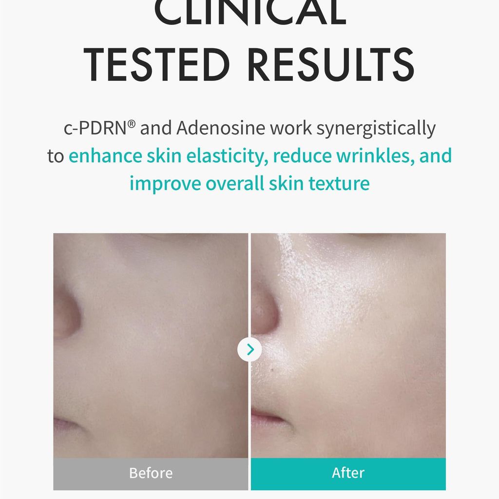 REJURAN® Turnover Mask, c-PDRN® (5ea) – Original Salmon DNA for Firming, Hydration, Repairing & Revitalizing. Achieve Youthful, Radiant Skin. Korean Skincare. Ultra Microfiber Sheet Mask