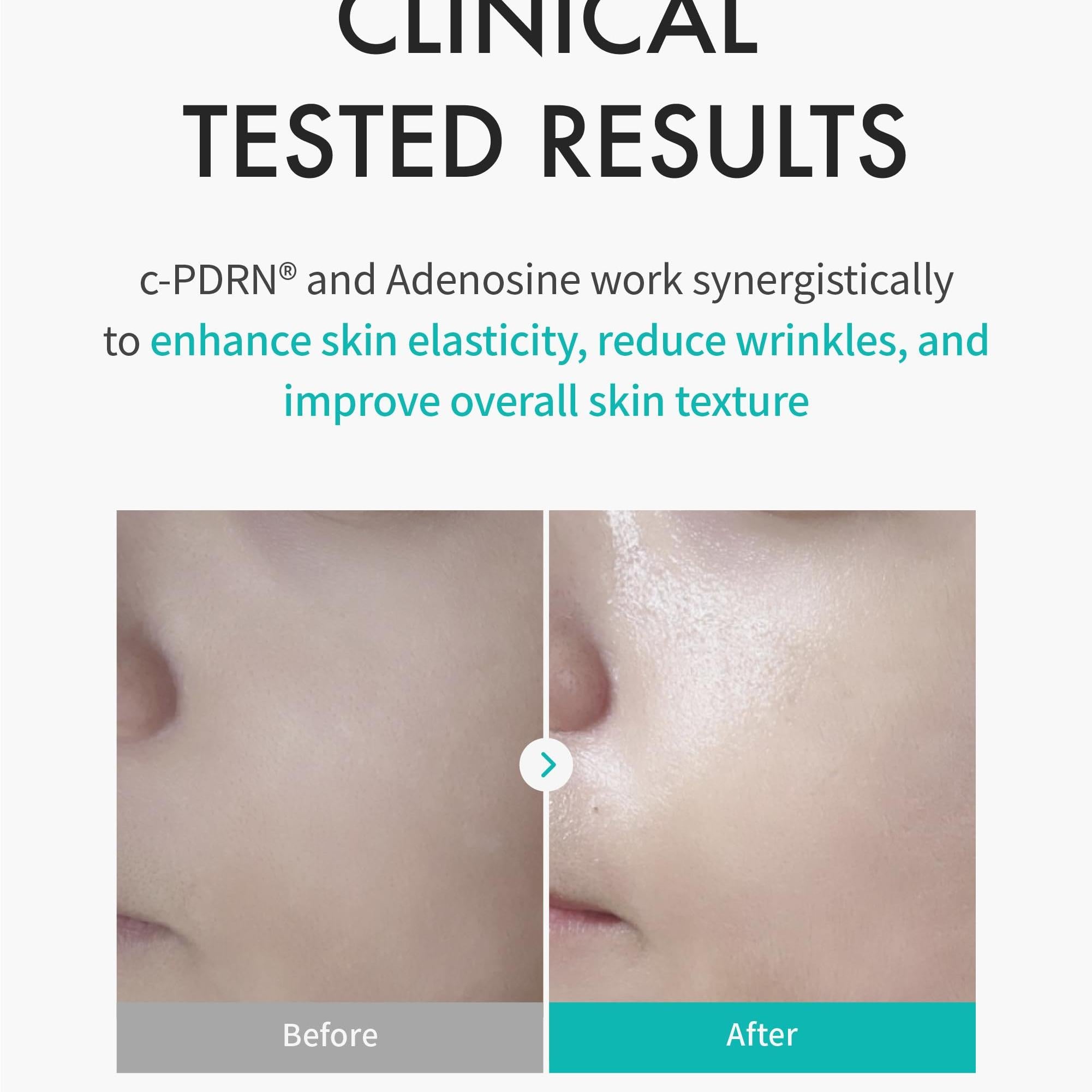 REJURAN® Turnover Mask, c-PDRN® (5ea) – Original Salmon DNA for Firming, Hydration, Repairing & Revitalizing. Achieve Youthful, Radiant Skin. Korean Skincare. Ultra Microfiber Sheet Mask