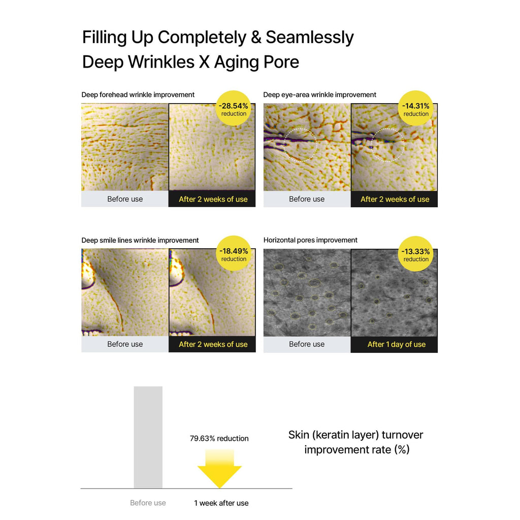 celimax The Vita A Retinal Shot Tightening Booster | 0.1% Retinal, 3% Matryxyl, High-Strength Retinoid for Anti-Aging, Pore Minimizer, Wrinkles & Fine Lines, Firmer Skin, 15ml