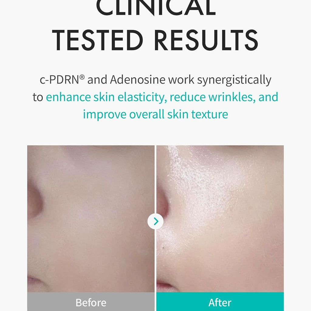 REJURAN® Turnover Skincare Set with c-PDRN® – Salmon DNA Face Serum & Sheet Mask Duo for Firming, Hydrating, and Radiant Glass Skin – Korean Anti-Aging Ampoule & Mask (1.69 fl oz + 5 Masks)