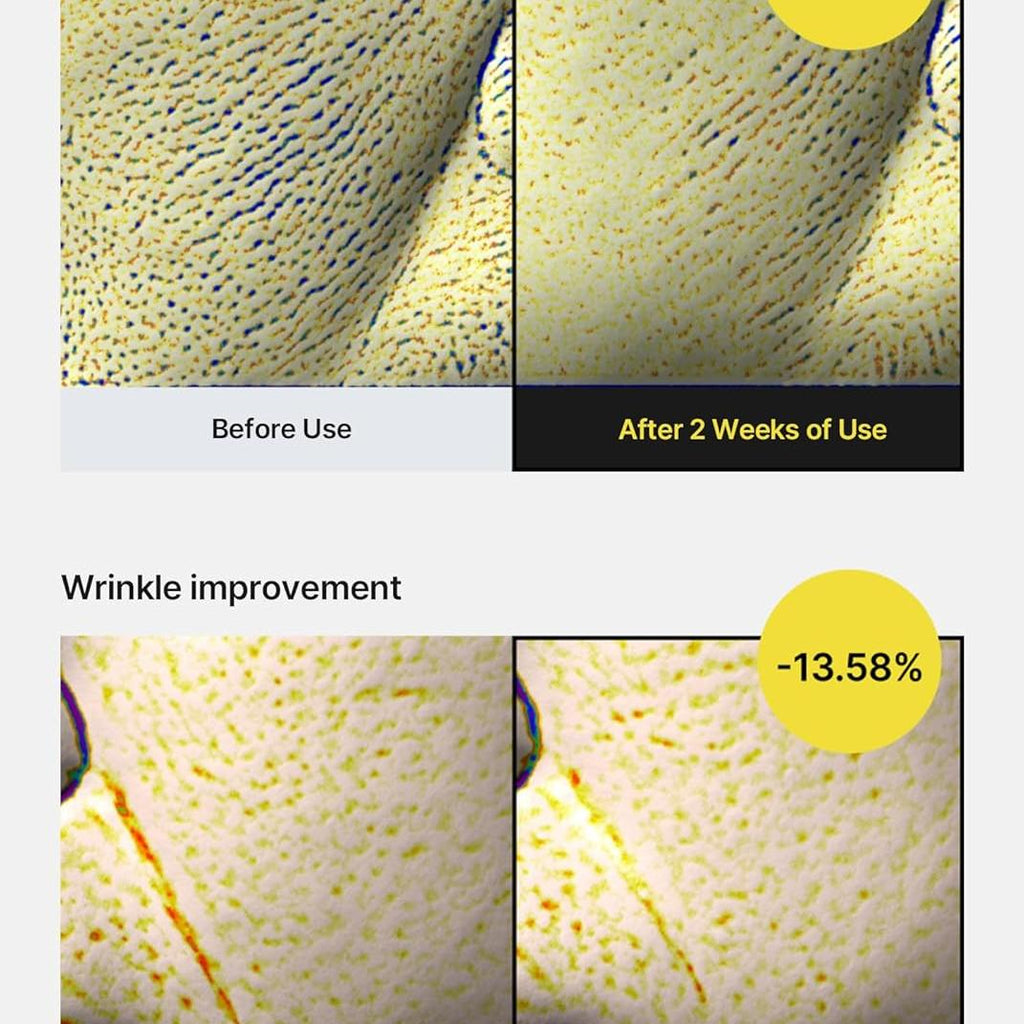 celimax The Vita A Retinol Shot Tightening Serum | with Pure Vitamin A Retinol, Peptide, Pore Minimizer, Wrinkles & Fine Lines, Firmer Skin, Anti-Aging, Skin Smoothing 30ml