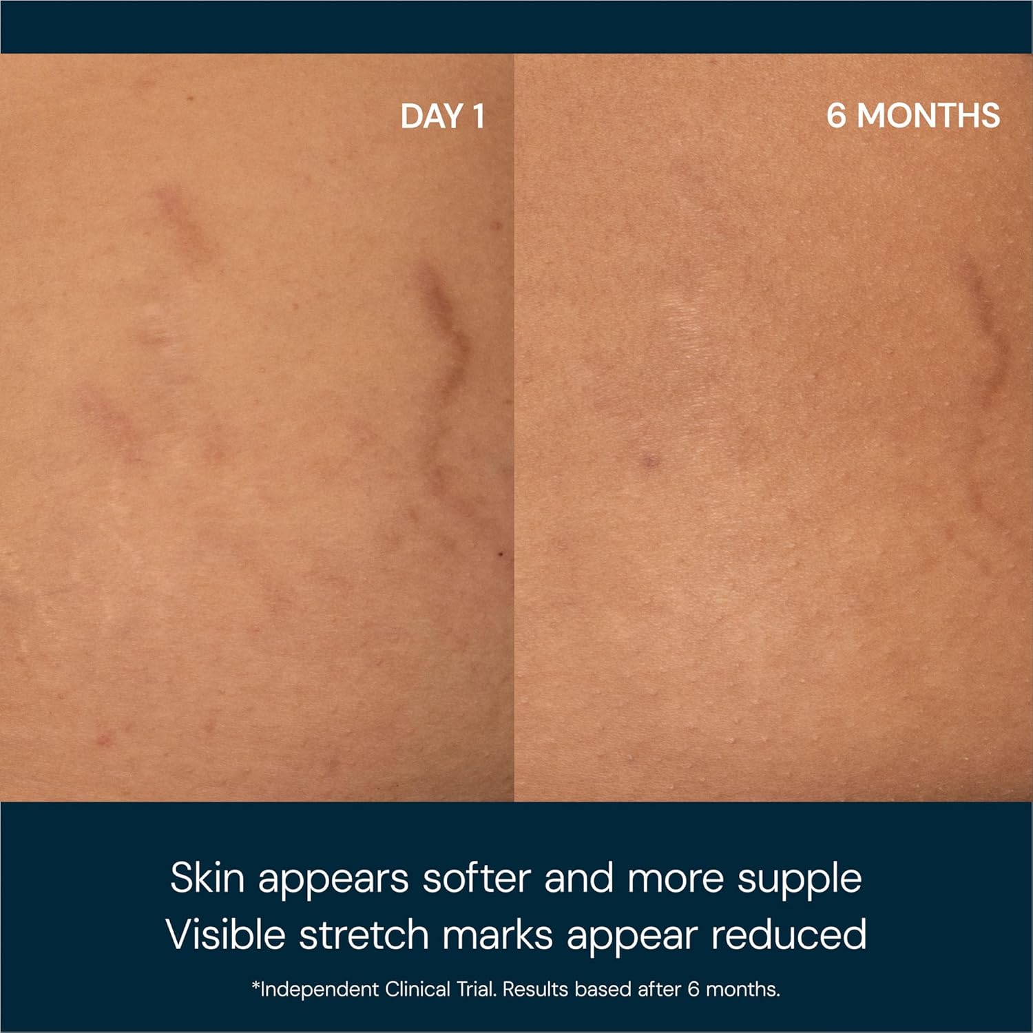 ELEMIS Japanese Camellia Body Oil Blend | Luxuriously Lightweight Body Oil Nourishes, Conditions, and Softens Pregnant and Postpartum Skin | 100 mL