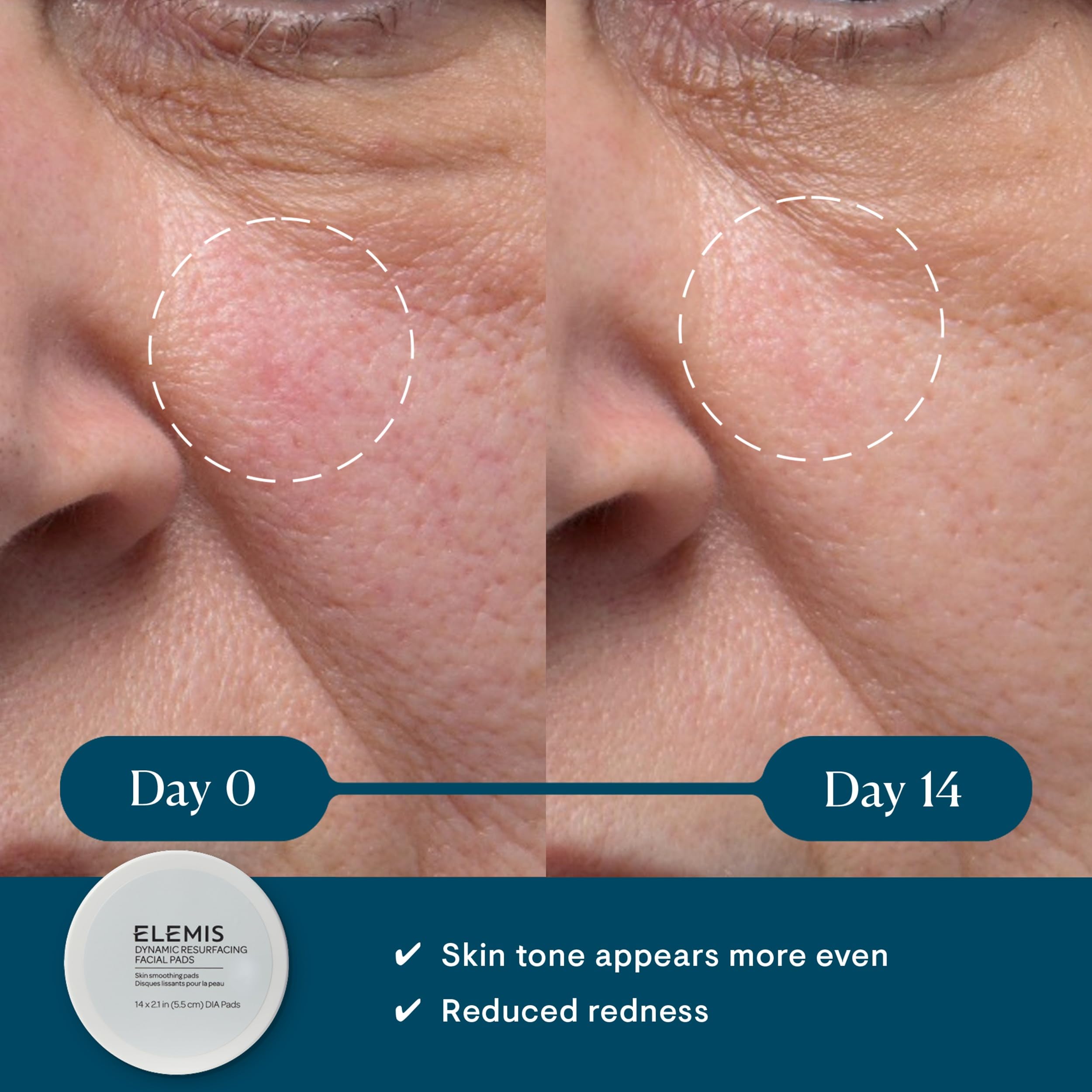 ELEMIS Dynamic Resurfacing Facial Pads, Gentle Textured Treatment Facial Exfoliating Pads