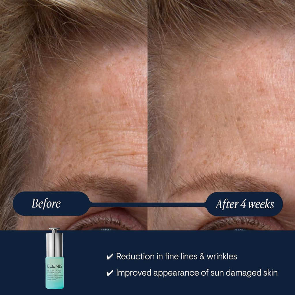 ELEMIS Pro-Collagen Renewal Serum 15ml, Gentle Retinol Alternative for Smoothing Fine Lines & Wrinkles