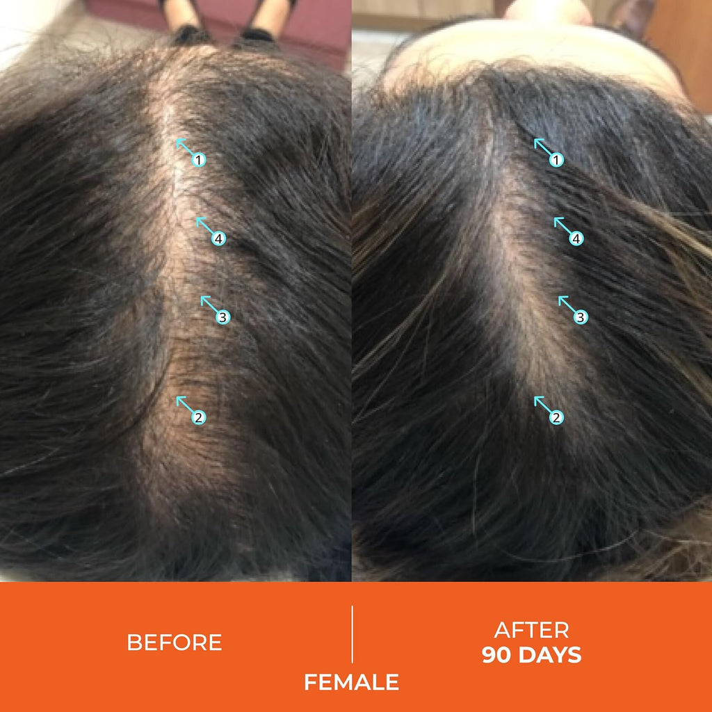 DS Labs Revita Hair Vitamin Gummies - Support for Thicker, Fuller Looking Hair, With Biotin, Zinc, Vitamin D, Iron, Magnesium & Melatonin, Vegan, Gluten-Free, Gelatin-Free, 60 Gummies